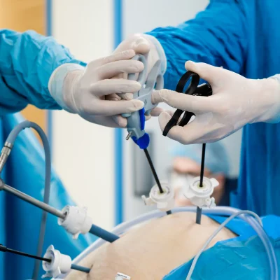 Laparoscopic (Keyhole) Surgery