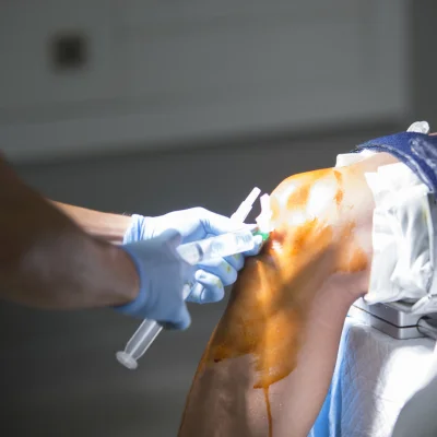 Pediatric Orthopedic Trauma