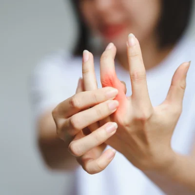 Rheumatoid Arthritis Treatment