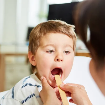 Tonsillitis Treatment